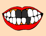 Desenho Boca e dentes pintado por Carie