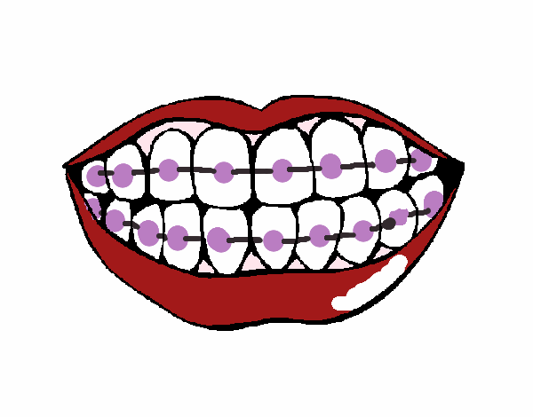 Desenho de Boca e dentes pintado e colorido por Usuário não registrado o  dia 25 de Março do 2009