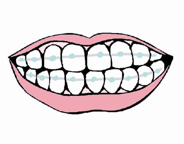 Desenho de Boca e dentes pintado e colorido por Ritucha o dia 25 de Março  do 2016